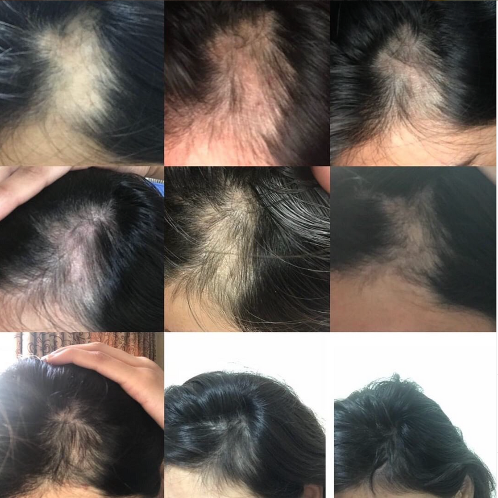 Progress images
